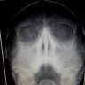 Doktor